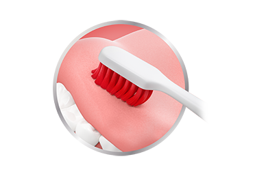 How You Can Prevent Bleeding Gums When Brushing Teeth